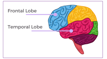 Graphic image that illustrates the frontal and temporal lobes of the brain.